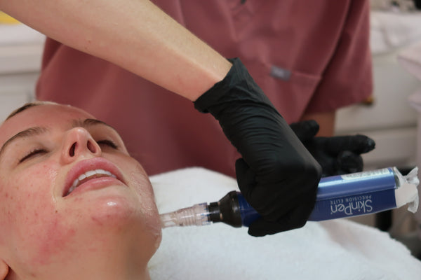 Microneedling